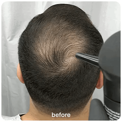 Hair Building Fibers (Imported)