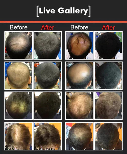 Hair Building Fibers (Imported)